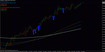 Price Action Forex – Why Forex Trading is Easy with Price Action?